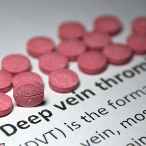 Deep Vein Thrombosis